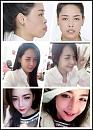 Click image for larger version

Name:	co-gai-nam-dinh-lot-xac-nho-phau-thuat-tham-my-2.jpg
Views:	0
Size:	24.5 KB
ID:	746232