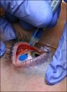 Click image for larger version

Name:	eye tattoo injection.jpg
Views:	0
Size:	46.3 KB
ID:	802078