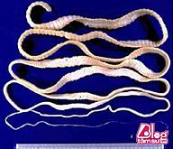 Click image for larger version

Name:	7891-88m-long-tapeworm-pulled-out-from-guys-stomach-world-of-buzz-2.jpg
Views:	0
Size:	130.9 KB
ID:	993402