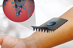 Click image for larger version

Name:	Microneedles.jpg
Views:	0
Size:	30.3 KB
ID:	1659168