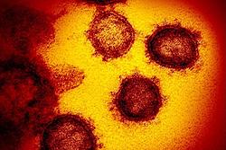 Click image for larger version

Name:	Coronavirus.jpeg
Views:	0
Size:	134.0 KB
ID:	1536633